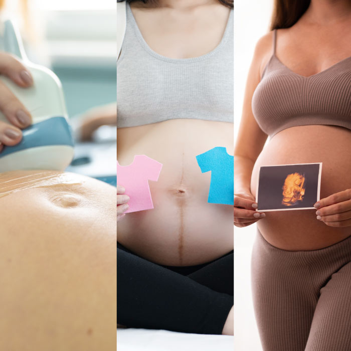 Análises Genéticas